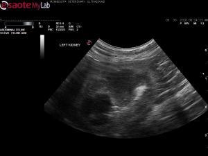 Renal urolithiasis vs. dystrophic mineralization