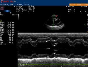 MMVD- treatment or not?