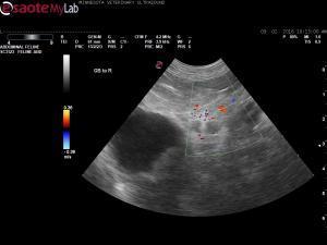12 yr FS West Highland X with a Gallbladder lesion