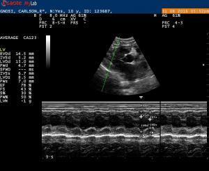 Cardiac vs non-cardiac disease