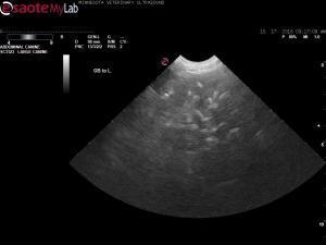 What is the significance of lobar calculi