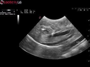 Neurological signs, hypoglycemia, severe anemia in an 8 week old Shepherd puppy