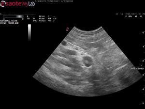 Hypernatremia in a 10 year old Ragdoll