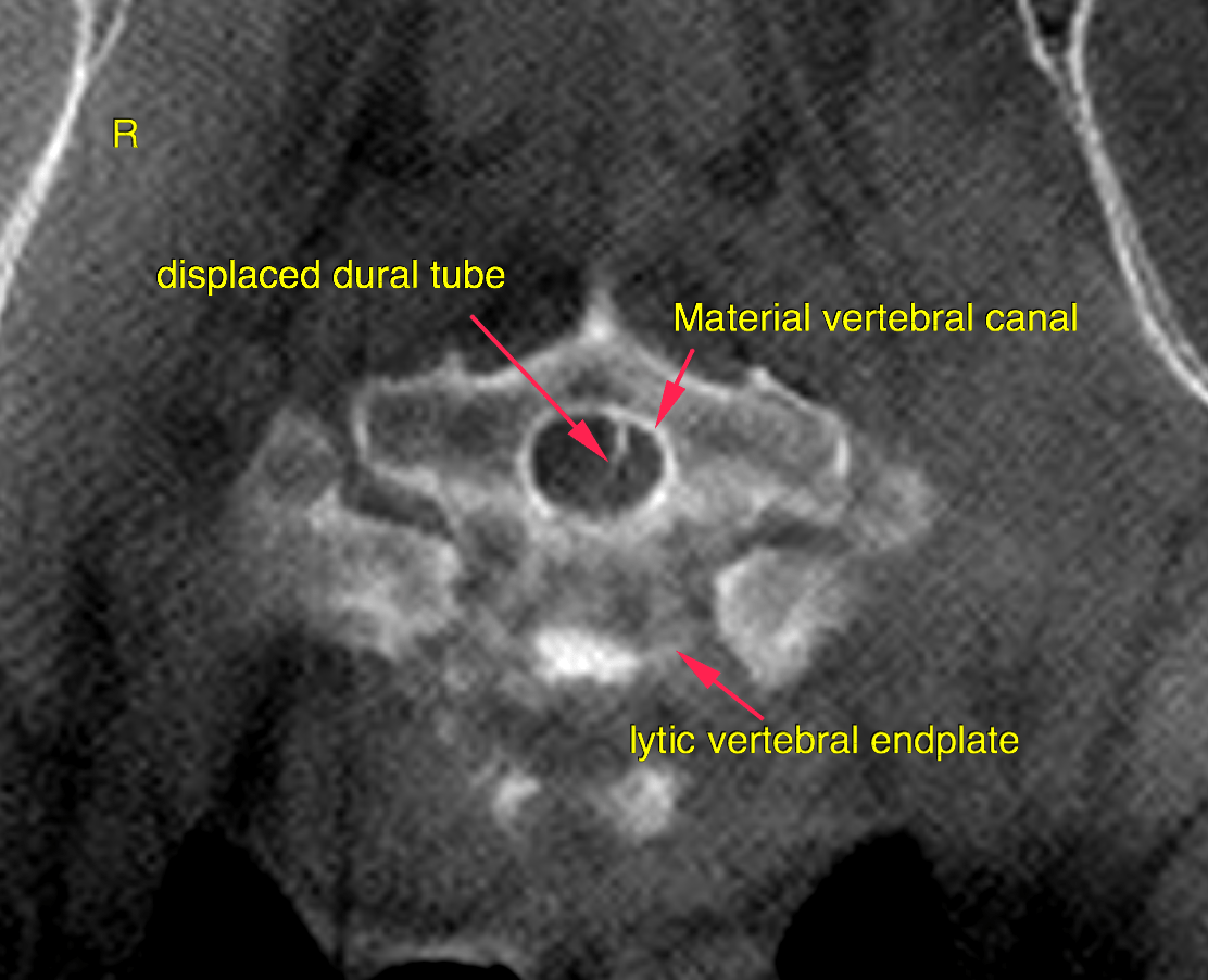 bildschirmfoto_2016-08-30_um_11