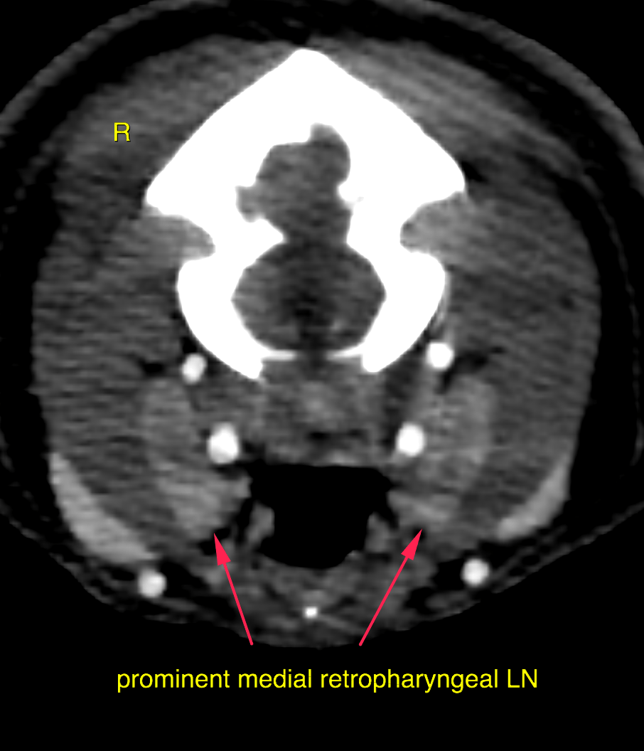 CT - Chronic rhinitis with mild destruction of nasal turbinates and ...