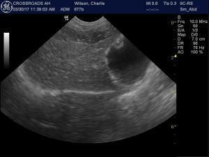 Cholecystitis – thoughts on further diagnostics?