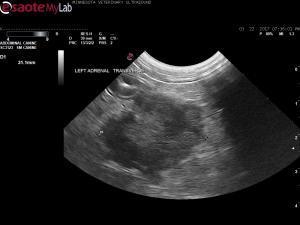 Dyspnea, pulmonary infiltrates, and adrenal gland tumor in a 10yr MN ShihTzuh