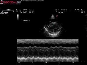 Heart base mass, RV enlargement, TVI, and moderate to severe dyspnea in a 12 year old Shihtzu X