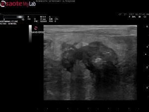 Caudal right abdominal mass seen in a dog with pancreatitis, diabetic ketoacidosis