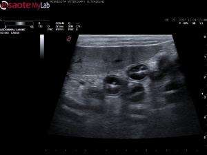 Hypoalbuminemia in an 8 year old MN Boxer