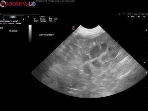 Echogenic renal cortical densities in a 10 year old FS German Shepherd
