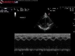 CHF in an 11 year old MN Lab
