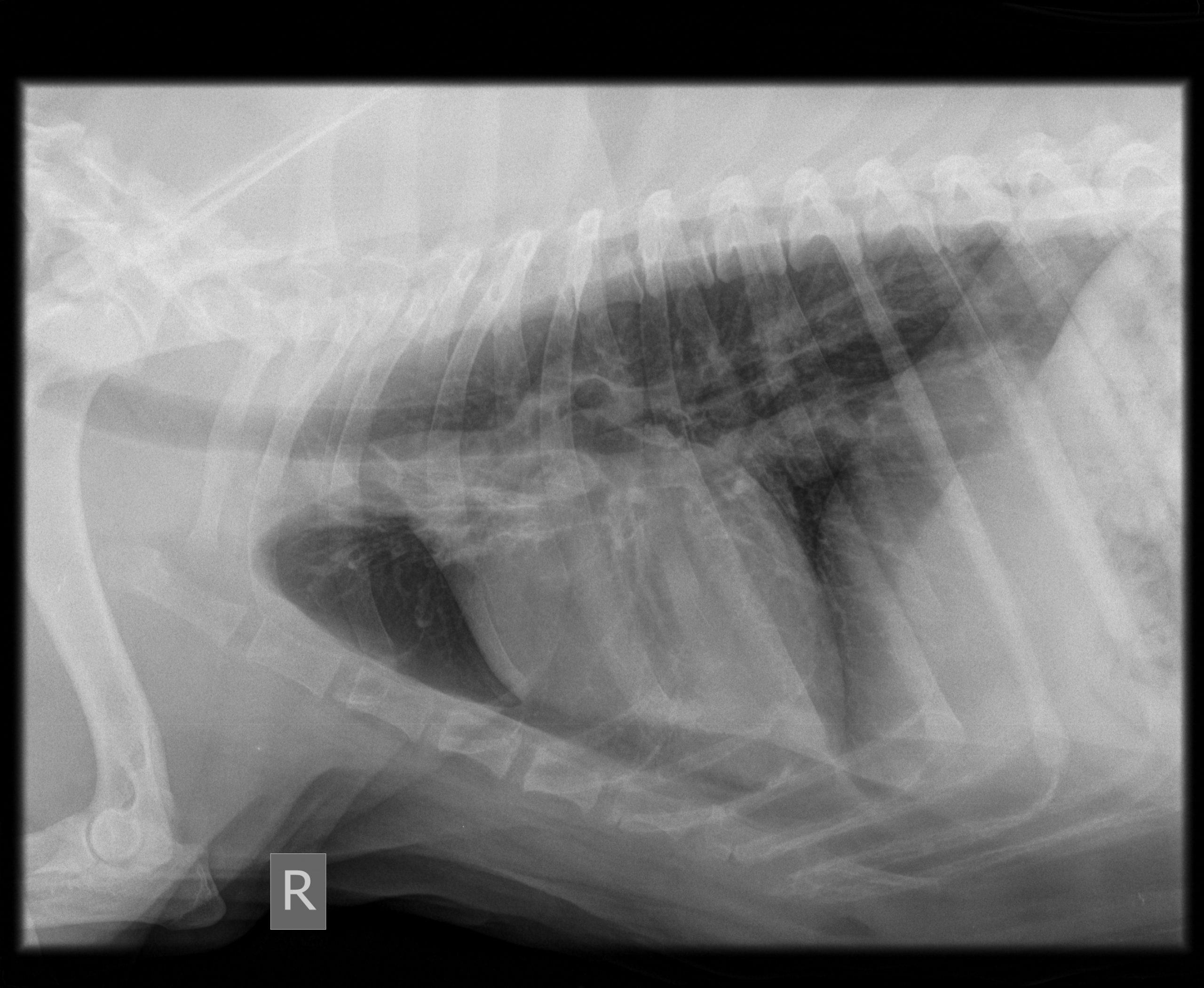 right_chest_2_months_post_tx_00022658_00041752_dicom_cr_2011_07_14_0000734351
