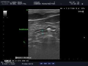 Cut-off for feline spleen thickness?