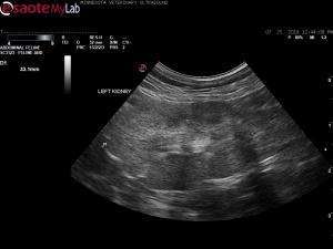 Vomiting cat with renal failure and GI wall changes