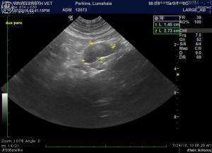 Multi-organ pathology without definitive cytology results