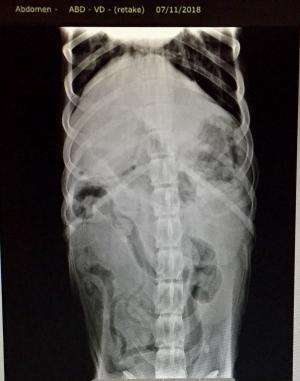 Gastric outflow obstruction?