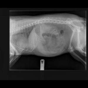 Abdominal mass
