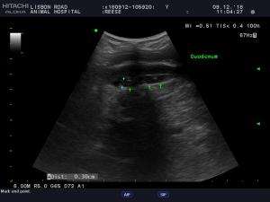 Pancreatic duct ?