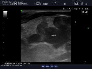 GI mass, FNA?