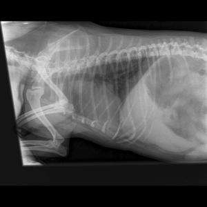 Mediastinal mass?