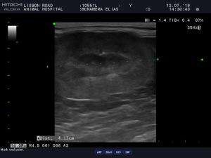 Cat, possible lymphoma