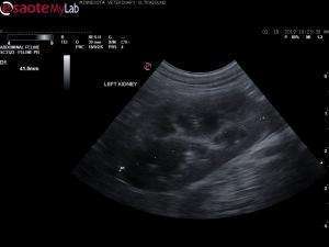 Chronically thirsty 10 month old dog with an elevated SDMA