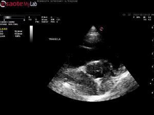 Possible RV enlargement without RV hypertrophy in HW positive dog