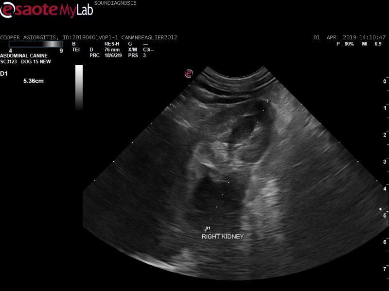 Hyperechoic fat surrounding kidney and spleen. - Members