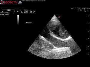 Would you FNA this?