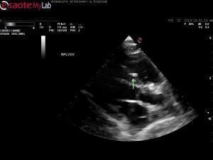 Heartworm positive dog