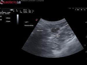 Post ethanol ablation parathyroid scan