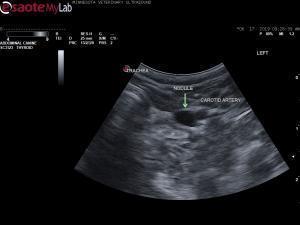 12 yr old mn sedated Shih Tzu with hypercalcemia