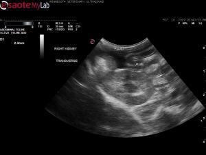 Two month old kitten with ascites and failure to gain weight
