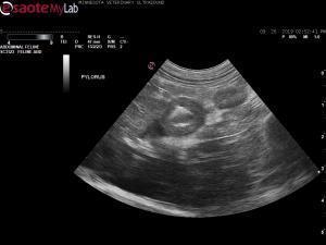 8yr old FS DSH with gastrointestinal lymphadenopathy