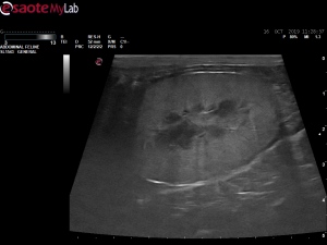 Cat kidneys