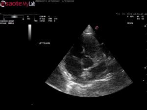 Suspect cardiac mass