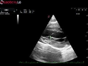 Cat cardiomyopathy