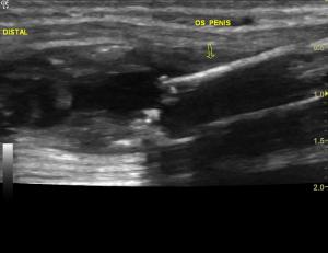 Distal urethral neoplasia?