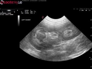 Is this renal dysplasia?