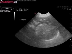 Rule out gastric mass in 10 year old MN lab