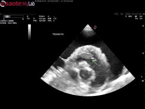 Abnormal RV wall and TV in 9 yr old Doberman