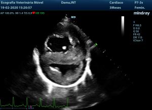 Persistent truncus arteriosus!