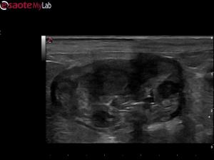 Conservative treatment options for gastric lymphoma