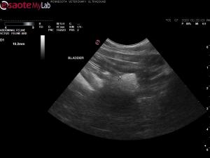 Psuedostones in a 10 year old mn DSH