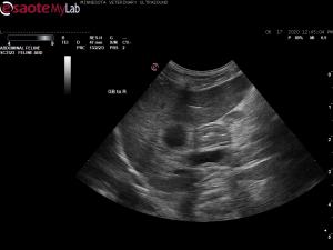 14yr FS DMH with distended GB, cystic duct and CBD