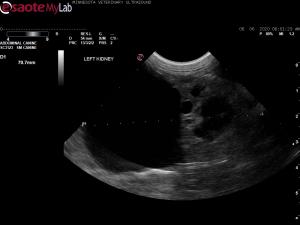 polycystic kidneys, cystic liver  and ascites in a 8yr old mn DSH