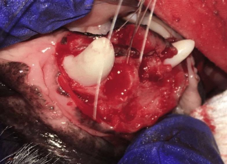 extracted_mobile_incisors_and_opened_with_alveloplasty_and_the_proximal_wedge_technique