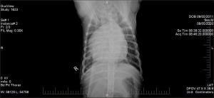 Eccentric RV enlargement in a 9 yr old dyspneic Pitbull