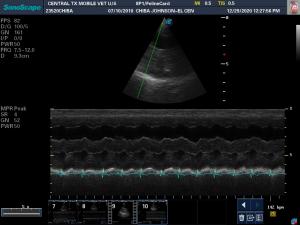 Pulmonary hypertension?